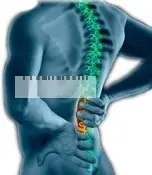 دانلود pdf مقاله  ورزش درمانی و علل بروز کمردرد‎ رایگان