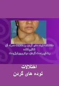 دانلود pdf کتاب  دانشنامه توده های گردن و اختلالات آن  رضا پوردست گردان رایگان