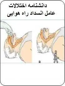 دانلود pdf کتاب  دانشنامه اختلالات عامل انسداد راه هوایی  رضا پور دستگردان رایگان