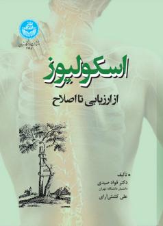 دانلود pdf کتاب اسکولیوز فواد صیدی