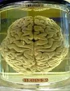 دانلود pdf کتاب فیزیولوژی مغز انسان حسین سلطاندوست رایگان