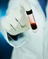 دانلود pdf کتاب کم خونی فقر آهن علی اصغر صفری فرد رایگان