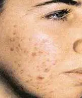 دانلود pdf کتاب راهنمای بیماریهای شایع پوست و مو دکتر محسن فیاض رایگان