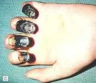 دانلود pdf کتاب PDF بیماری طاعون را بشناسید دکتر حسین حاتمی رایگان