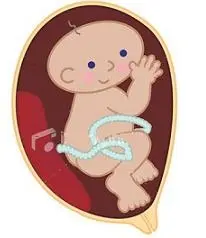 دانلود pdf کتاب PDF درباره سقط جنین آرش نراقی رایگان