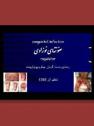دانلود pdf کتاب  عفونتهای نوزادی  رضا پوردست گردان رایگان