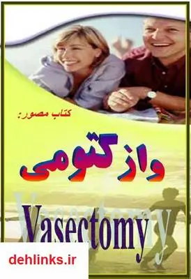 دانلود pdf کتاب وازکتومی باقر زاده