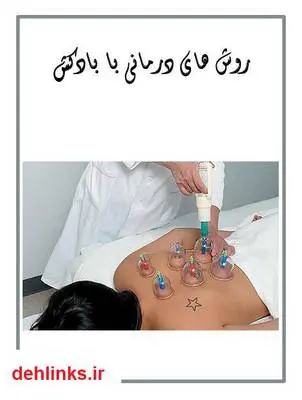 دانلود pdf کتاب روش های درمانی با بادکش نیما نیک نژاد