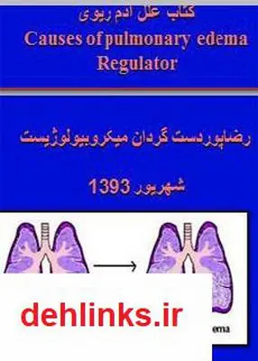 دانلود pdf کتاب علل ادم ریوی رضا پوردستگردان