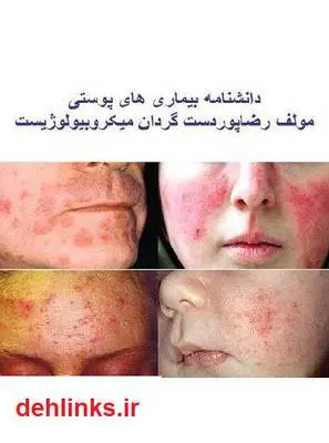 دانلود pdf کتاب دانشنامه بیماری های پوست رضا پوردستگردان