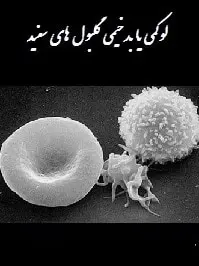 دانلود pdf کتاب  لوکمی یا بدخیمی گلبول های سفید  علی اصغر صفری فرد رایگان