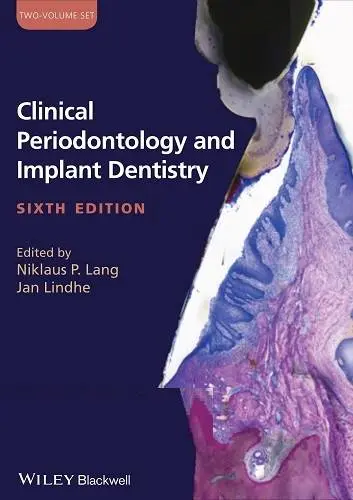 دانلود pdf کتاب پریودنتولوژی بالینی و دندانپزشکی ایمپلنت ویرایش 6 رایگان