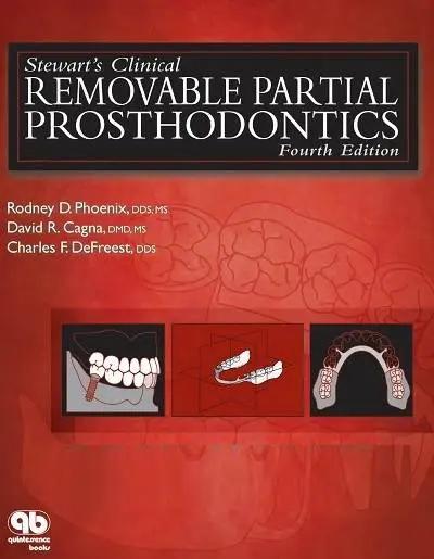 دانلود pdf کتاب پروتزهای متحرک جزئی بالینی استوارت ویرایش 4 رایگان