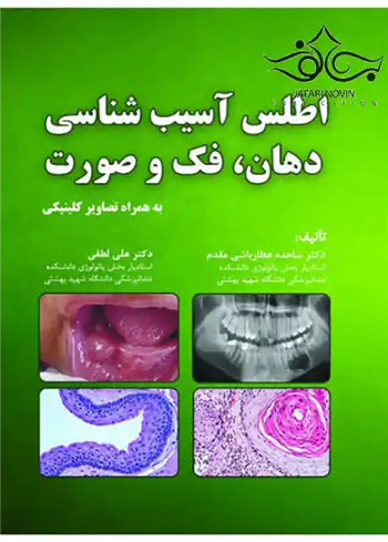 دانلود pdf کتاب اطلس آسیب شناسی دهان فک و صورت ساعده عطارباشی مقدم